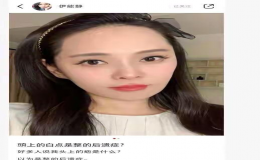 額頭白點(diǎn)被疑整形后遺癥 伊能靜親揭真相