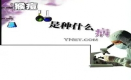 關(guān)于猴痘病毒  這些常識(shí)你要知道