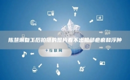  陳慧琳復(fù)工后拍攝的照片看不出臉部疤痕和浮腫